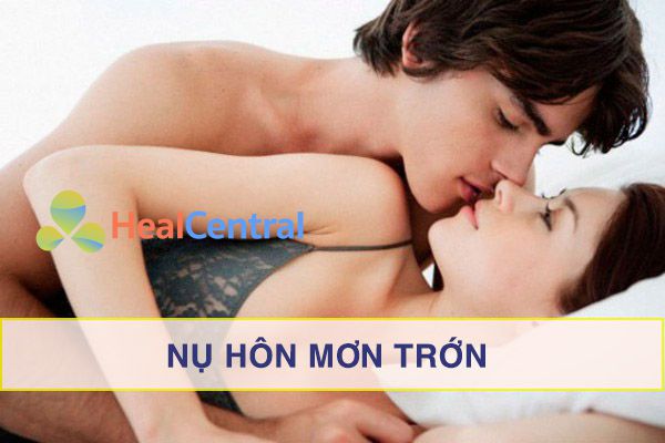 Bắt đầu cuộc chơi bằng một nụ hôn nồng cháy