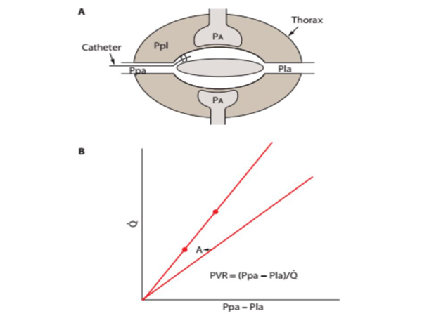 Cách thường dùng để đo lường các thông số huyết động với catheter động mạch phổi (PAC)