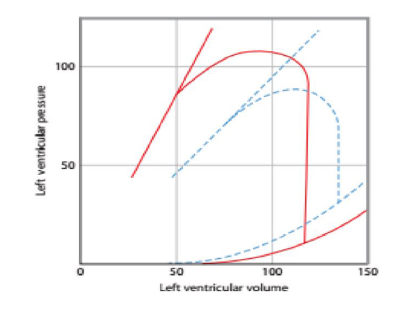 Giản đồ miêu tả mối liên quan thể tích áp lực LVEDV và LVEDP