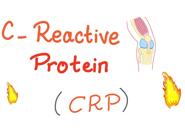 Protein phản ứng C (CRP) là tiêu chuẩn vàng để đánh giá mức độ nghiêm trọng của viêm tụy cấp